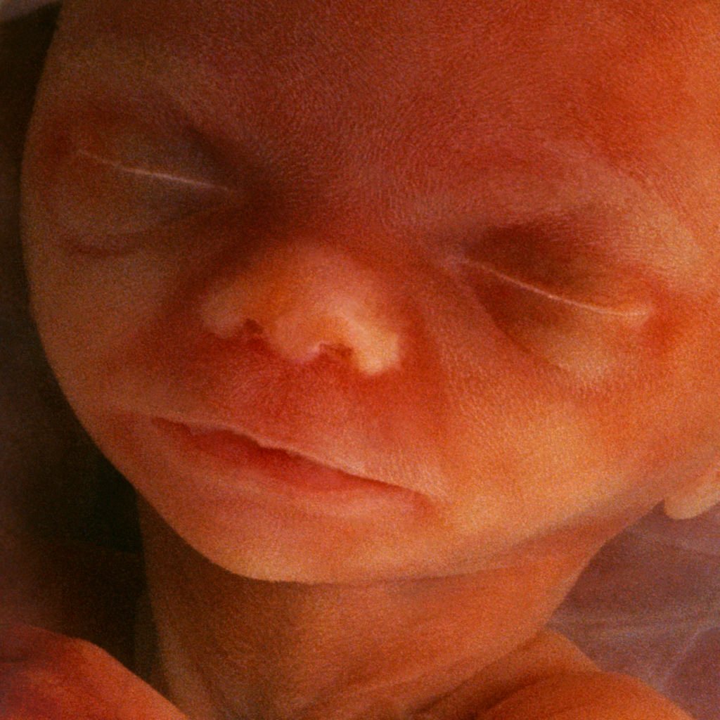 Imagem de bebê não nascido (postagem sobre abortos em hospitais adventistas