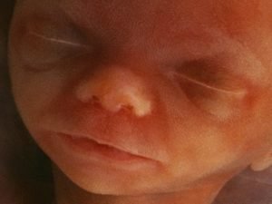 Imagem de feto (Postagem: Aborto em hospitais adventistas)
